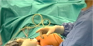 Ca’ Foncello, microonde per sciogliere il tumore al fegato