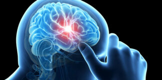 Sospetta “mucca pazza” a Pieve di Soligo