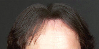 Coronavirus, Red Canzian per il crowdfunding