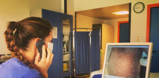 Dermatologia, al Ca’ Foncello visite ai pazienti da remoto