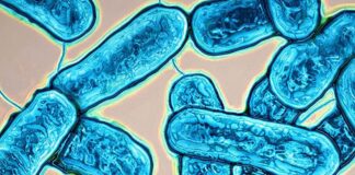 Legionella, il Sisp scongiura l’ipotesi epidemia: “Solo sei casi senza correlazione”