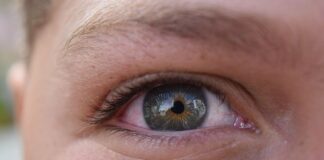 Congiuntivite allergica: cos’è e come curarla