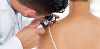 Melanoma: casi in aumento