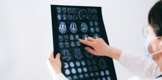 Cervello: un “interruttore” contro la neurodegenerazione