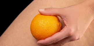 Cellulite: meglio il caldo o il freddo?