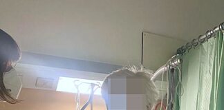 Operata al femore a 103 anni, dopo 4 giorni riprende a camminare La signora 103enne in piedi dopo l'intervento al femore