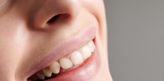 ORTODONZIA: tutto quello che c’è da sapere ortodonzia