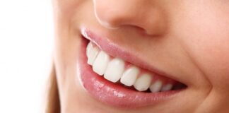Come sbiancare i denti: consigli per la tua igiene orale sbiancamento denti