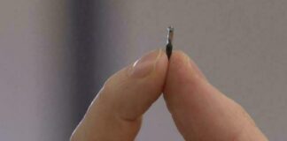 Chip sottocutaneo fa recuperare l’udito a un uomo, Zaia “Tecnologia straordinaria”