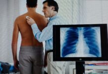 Intelligenza artificiale in Pneumologia: innovazione al Ca’ Foncello intelligenza artificiale, pneumologia, fluoroscopia aumentata, tumore polmone, broncoscopia, sanità, innovazione medica, Treviso, diagnosi