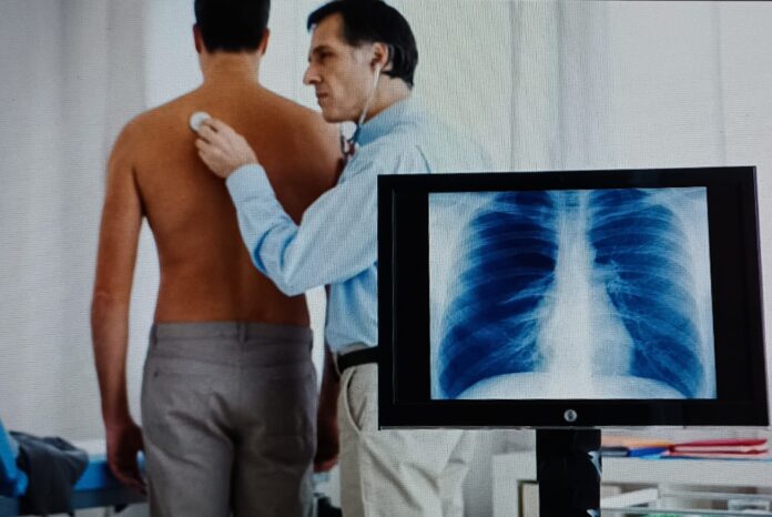 intelligenza artificiale, pneumologia, fluoroscopia aumentata, tumore polmone, broncoscopia, sanità, innovazione medica, Treviso, diagnosi intelligenza artificiale, pneumologia, fluoroscopia aumentata, tumore polmone, broncoscopia, sanità, innovazione medica, Treviso, diagnosi
