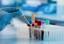 Trapianti cellule staminali, superati i mille al Ca’ Foncello trapianti cellule staminali, ematologia, Treviso, donazione organi, leucemia, mieloma, linfomi, sanità veneta