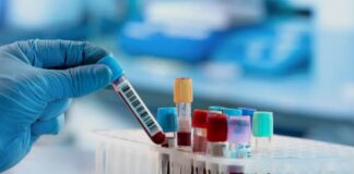 Trapianti cellule staminali, superati i mille al Ca’ Foncello trapianti cellule staminali, ematologia, Treviso, donazione organi, leucemia, mieloma, linfomi, sanità veneta