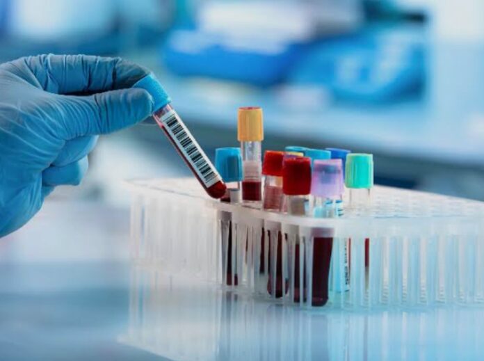 trapianti cellule staminali, ematologia, Treviso, donazione organi, leucemia, mieloma, linfomi, sanità veneta trapianti cellule staminali, ematologia, Treviso, donazione organi, leucemia, mieloma, linfomi, sanità veneta