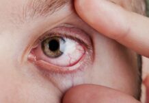 Degenerazione maculare: nuova sperimentazione in Italia per la cura degenerazione maculare, salute, ricerca medica