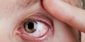 Degenerazione maculare: nuova sperimentazione in Italia per la cura degenerazione maculare, salute, ricerca medica