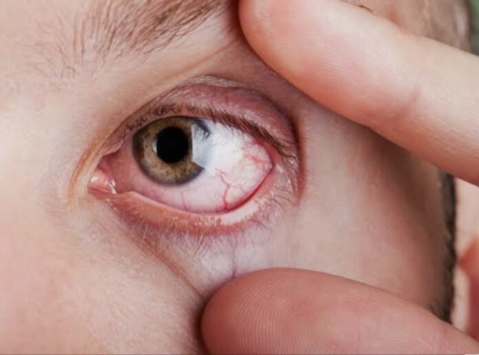 degenerazione maculare, salute, ricerca medica degenerazione maculare, salute, ricerca medica