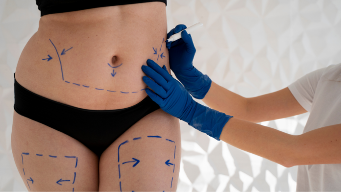 Chirurgia estetica e benessere psicologico - Notizie Plus Chirurgia estetica e benessere psicologico - Notizie Plus
