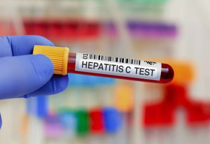 Epatite C, Ulss 2, Screening gratuito Epatite C, Ulss 2, Screening gratuito