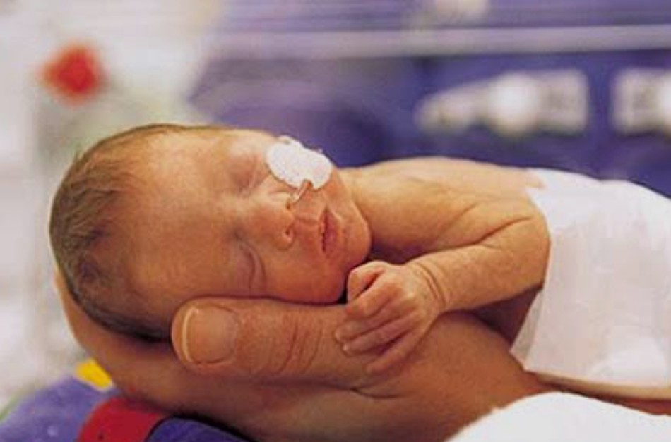 Prematurità, Ca’ Foncello, Ulss 2, salute mentale